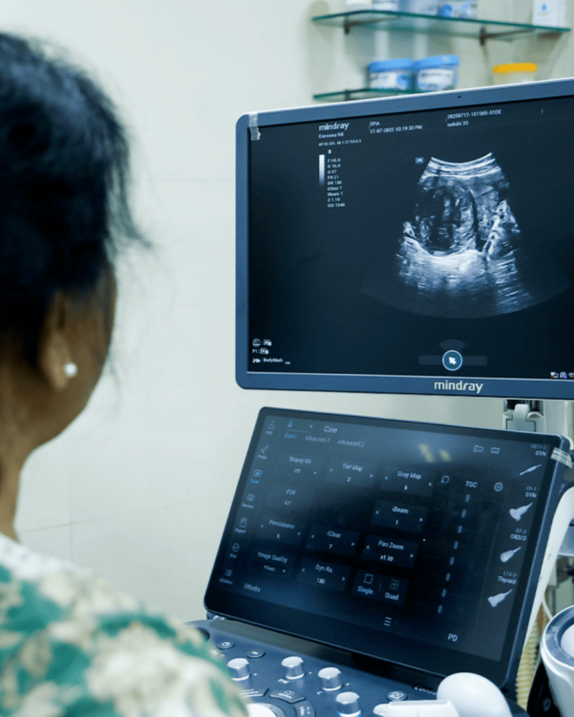 Patient viewing ultrasound scan at EPIA Delhi for fertility and reproductive health assessment